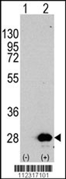 HSPB1 Antibody (S82)