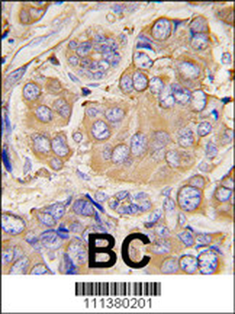 HSP27 (HSPB1) Antibody (S78)