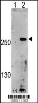 PIP5K3 Antibody (Center)