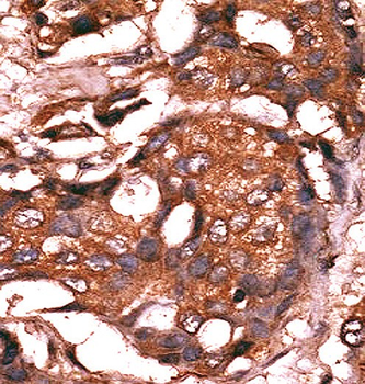 Guanylyl Cyclase alpha 1 (GUCY1A3) Antibody (N-term)