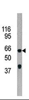 ADCK5 Antibody (C-term)