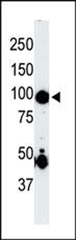 Germinal Center Kinase (GCK/MAP4K2) Antibody (Center)