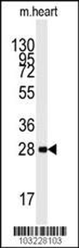 AMPK beta (PRKAB1) Antibody (N-term)