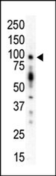 PKC mu Antibody (N-term)