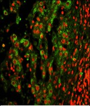 ITGAX Antibody (C-term)