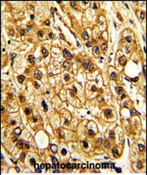 ITGAX Antibody (C-term)
