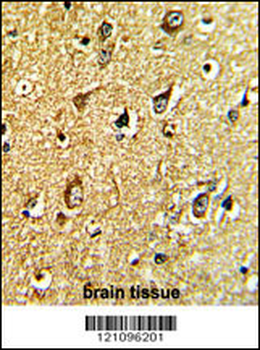 TH Antibody (C-term)