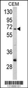 ND5 Antibody (C-term)