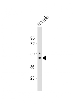 KCNJ2 Antibody (C-term)