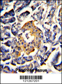 SRP72 Antibody (Center)