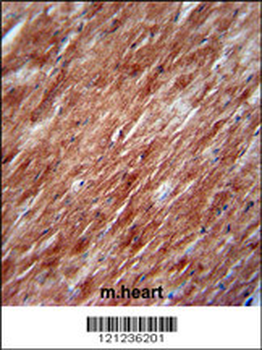IL2 Antibody (Center)