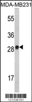 IL2 Antibody (Center)