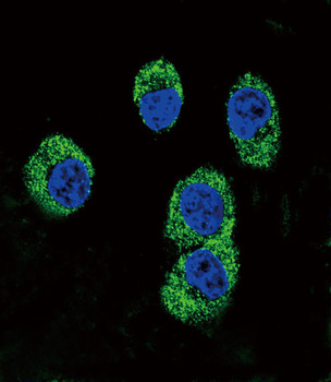 RAGE Antibody (Center)