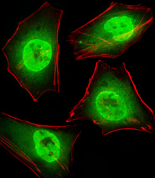 GTF2I Antibody (C-term)