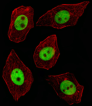GTF2I Antibody (C-term)
