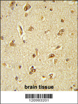 GTF2I Antibody (C-term)
