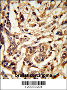 GALT Antibody (C-term)
