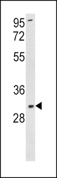 SOD3 Antibody (N-term)