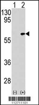MAP3K7IP1-S423 Antibody