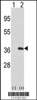 IL1A-S87 Antibody