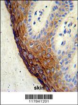 ECE-1 Antibody (C-term)