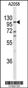 ECE-1 Antibody (C-term)