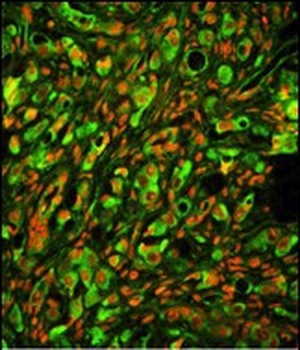 PTP4A2 Antibody (Center)