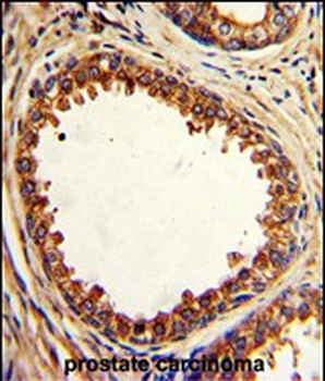 PTP4A2 Antibody (Center)