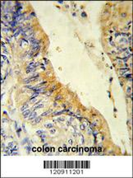 ACADM Antibody (Center)