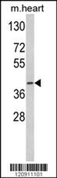 ACADM Antibody (Center)