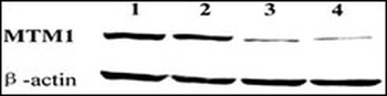 MTM1 Antibody (C-term)
