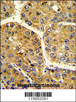 TF Antibody (C-term)
