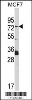 TF Antibody (C-term)