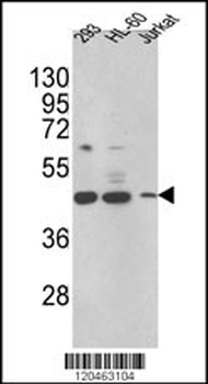 HSD17B7 Antibody (N-term)