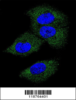 M-CSF Antibody (Center)