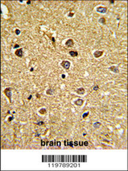 CHC1L Antibody (N-term)