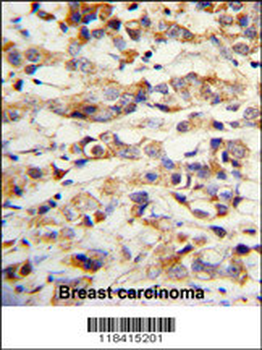 KRT14 Antibody (Center)