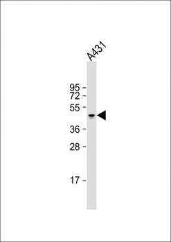 KRT14 Antibody (Center)