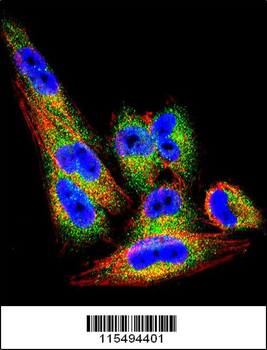 TIMP1 Antibody (N-term)