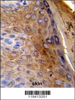 KRT10 Antibody (Center)