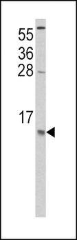 CCL2 Antibody (C-term)