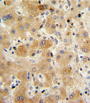 TTR Antibody (Center)