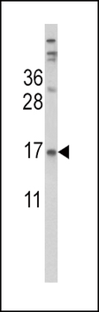 TTR Antibody (Center)