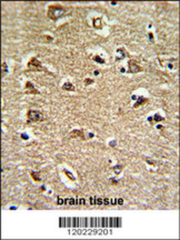 RAN Antibody (N-term)