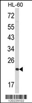 RAN Antibody (N-term)