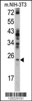 RAN Antibody (N-term)