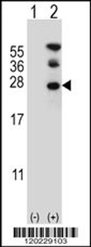 RAN Antibody (N-term)