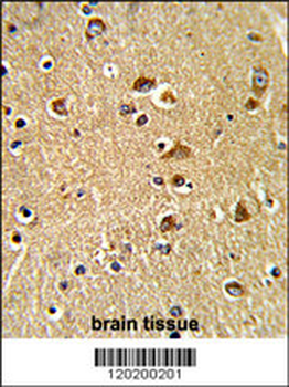 PDIA6 Antibody (Center D251)