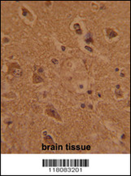 CTDP1 Antibody (N-term)