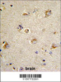 CDCA3 Antibody (N-term)